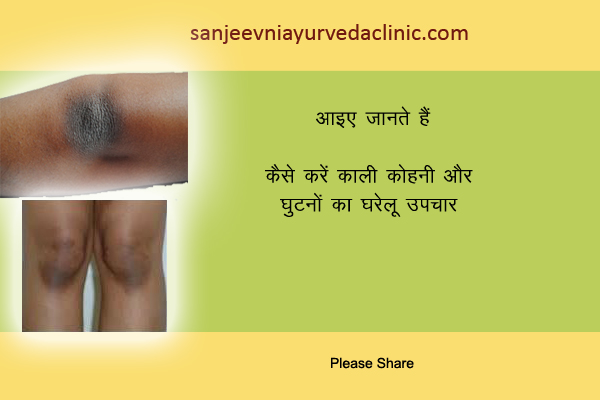 skin-remedies-dark-elbow-knee-ayurveda-tips.jpg