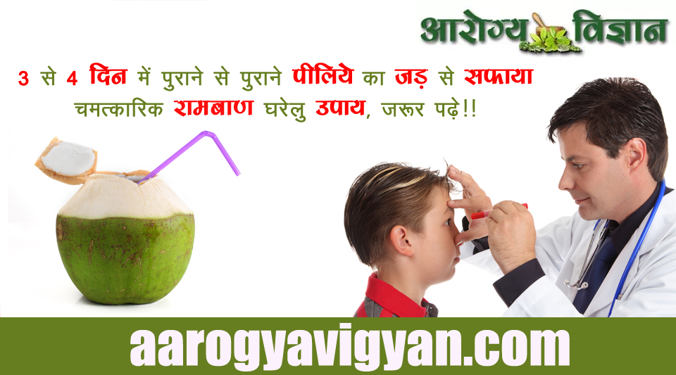 herbal-ayurvedic-home-remedy-treatment-cure-for-jaundice-benefits-of-green-coconut-water-piliya-ka-ramban-gharelu-ilaj-upay-upchar-nuskha-hare-nariyal-pani-ke-fayede